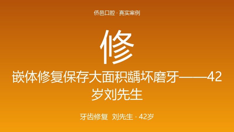 嵌体修复保存大面积龋坏磨牙——42岁刘先生