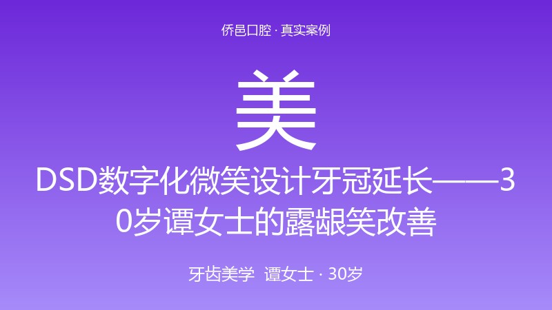 DSD数字化微笑设计牙冠延长——30岁谭女士的露龈笑改善