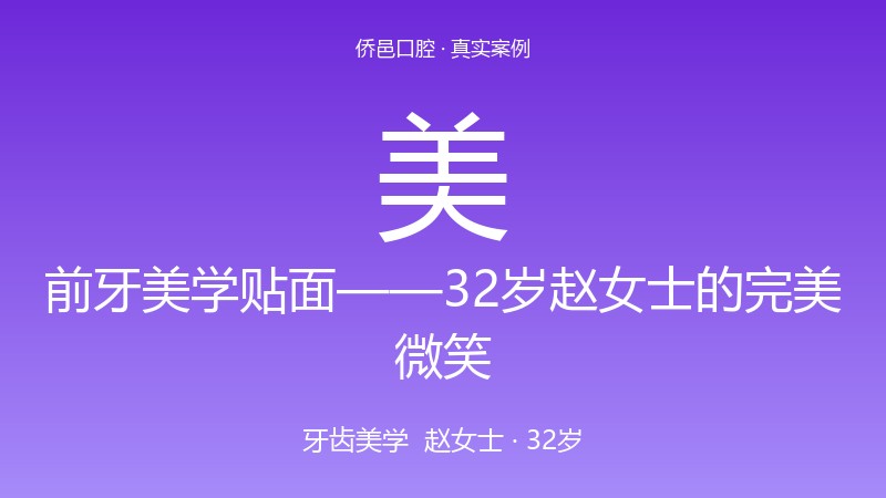前牙美学贴面——32岁赵女士的完美微笑